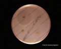 listeria monocytogenes